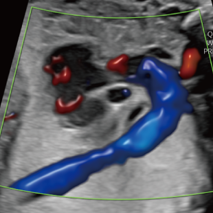 胎児ドックの様子_後期_心臓