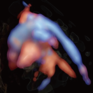 胎児ドックの様子_後期_心臓